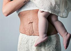 12 φωτογραφίες γυναικών που δείχνουν πώς αλλάζει το σώμα μετά την εγκυμοσύνη