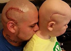 Ένας υπέροχος μπαμπάς κάνει τατουάζ την ουλή του γιου του για να του δείξει την αγάπη του