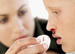 Άνοιξε η μύτη του παιδιού: Πώς θα αντιμετωπίσετε τη ρινορραγία