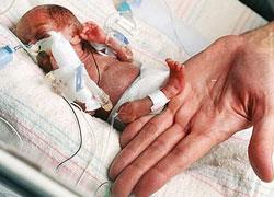 Γεννήθηκε στις 25 εβδομάδες και κατάφερε να ζήσει!