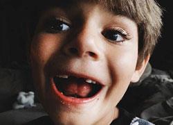 Όταν κουνιέται το δόντι του παιδιού: Η στιγμή που… δεν αντέχω!