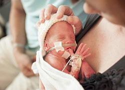 12 πρόωρα μωρά που αποδεικνύουν ότι είναι οι πραγματικοί νικητές της ζωής!