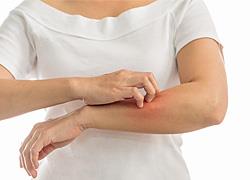 Κρούσμα του ιού του Δυτικού Νείλου στην Αργολίδα: Πήρε εξιτήριο ο ασθενής