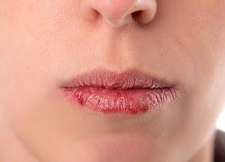 Τι δείχνουν τα χείλη για την υγεία σας: 9 ανησυχητικά σημάδια