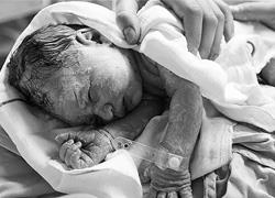 Όλα όσα πρέπει να γνωρίζετε για τον φυσιολογικό τοκετό