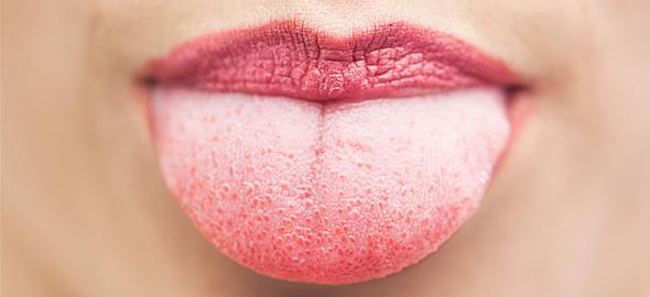 Τι μαρτυρά η γλώσσα για την κατάσταση της υγείας σας