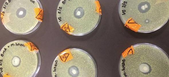 Ένα απλό πείραμα αποδεικνύει πώς το μητρικό γάλα καταπολεμά τους ιούς!