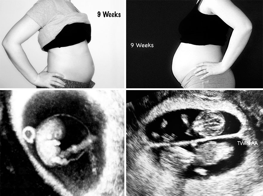 Ребенок в 10 недель беременности фото
