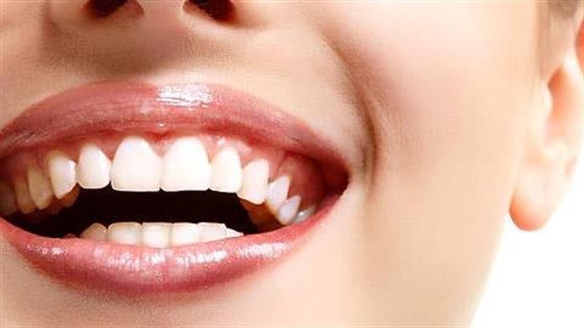 Πώς θα κάνετε μόνοι σας πιο λευκά τα δόντια σας!
