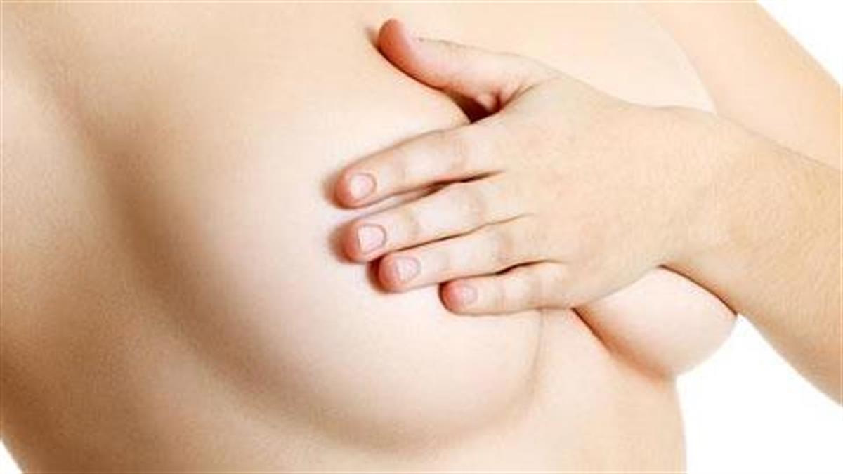 Καλοήθεις παθήσεις μαστού: Πού οφείλονται και πώς αντιμετωπίζονται