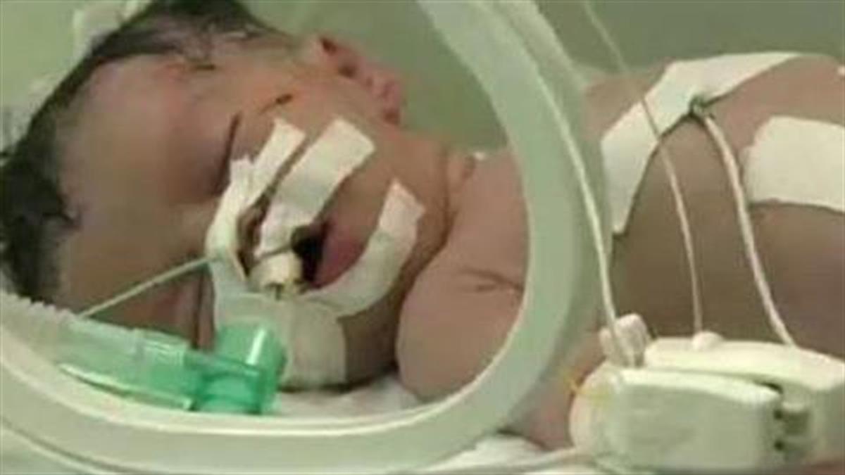 Βρέφος βγήκε ζωντανό από νεκρή μητέρα στην Γάζα: Το βίντεο συγκλονίζει!