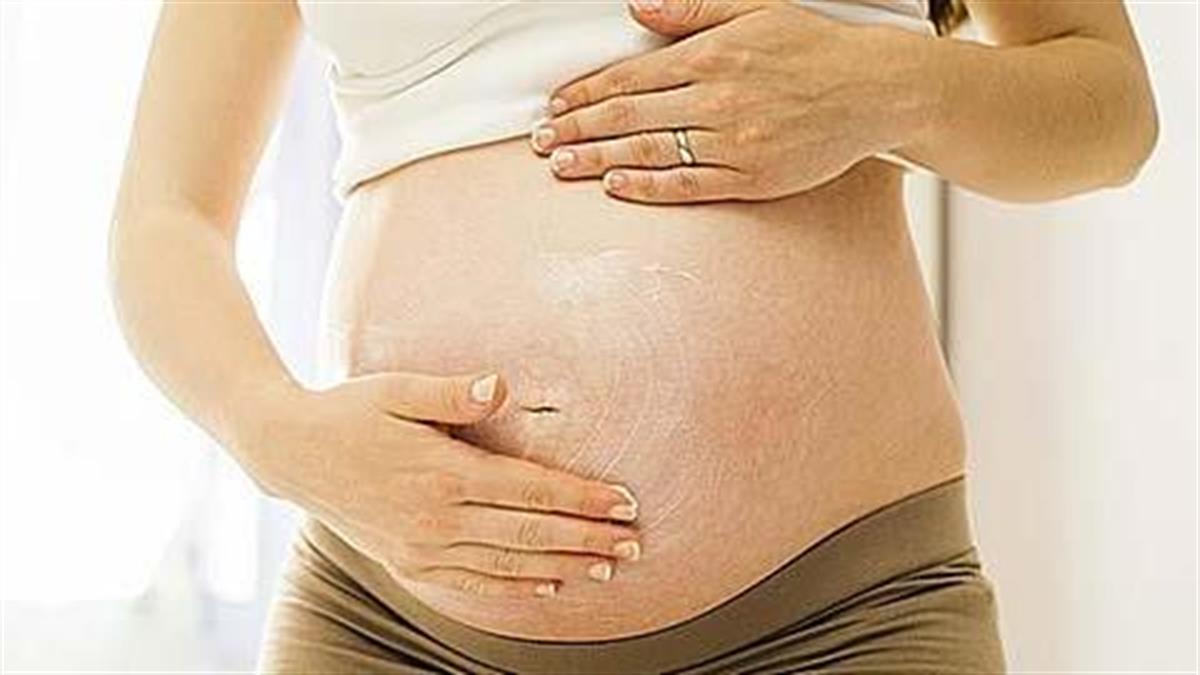 Ραγάδες εγκυμοσύνης: Απαλλαγείτε με φυσικό τρόπο!