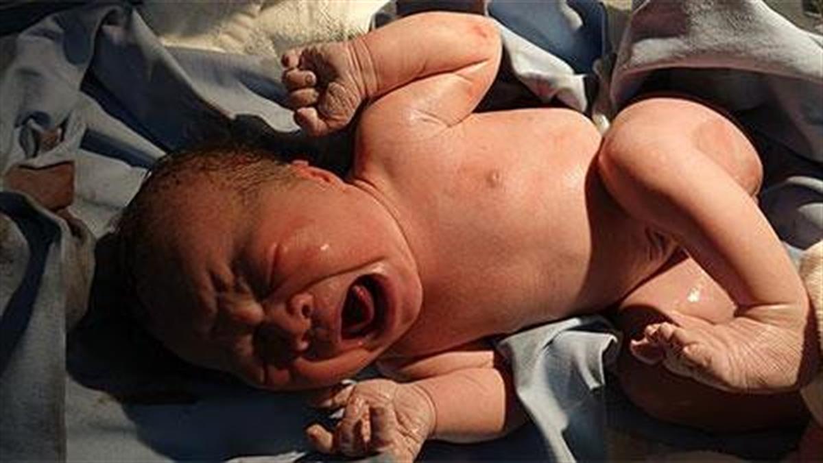 Αν το μωρό γεννηθεί και δεν κλάψει τι σημαίνει;