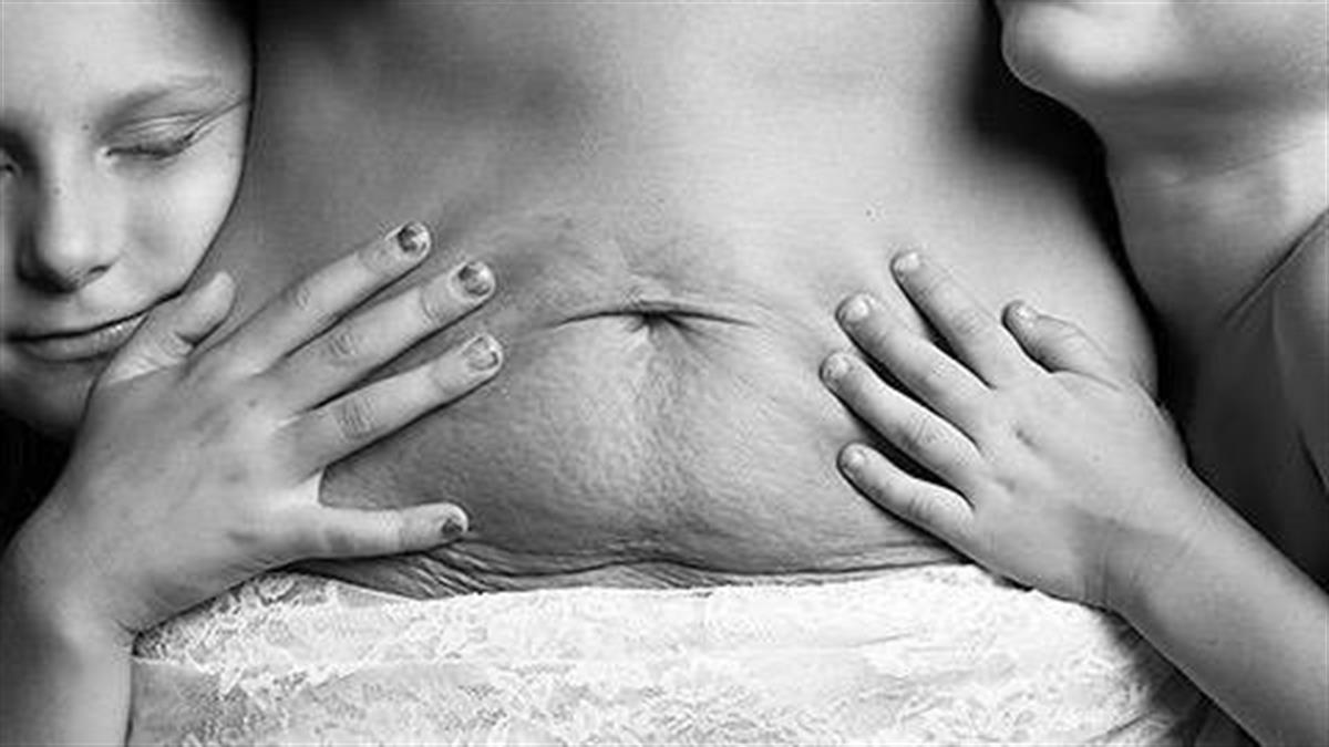Μαμάδες φωτογραφίζονται γυμνές μετά την γέννα