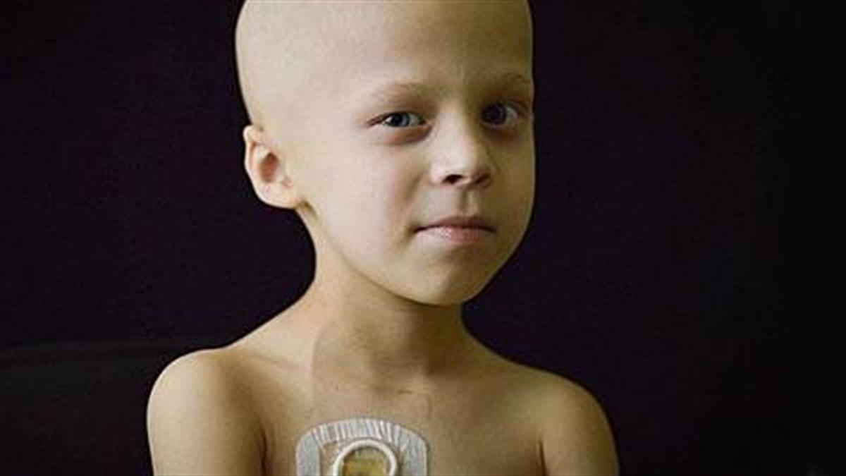 Πώς είναι να μεγαλώνεις ένα παιδί με καρκίνο σε 35 συγκλονιστικές φωτογραφίες
