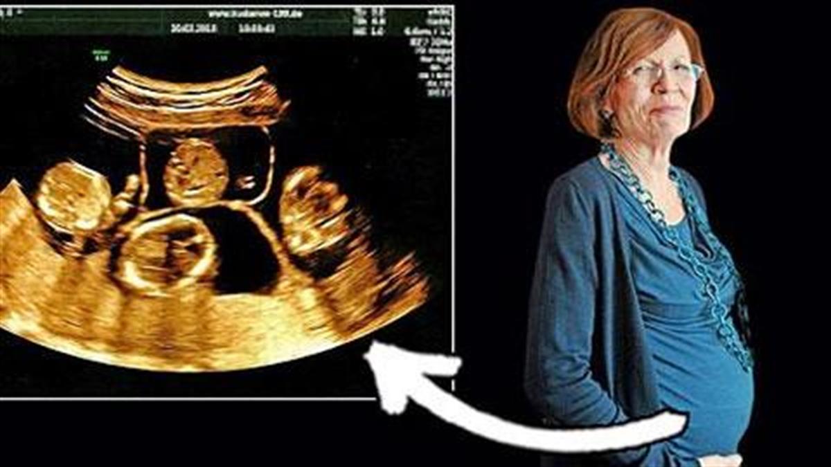65χρονη μητέρα 13 παιδιών είναι έγκυος σε τετράδυμα!