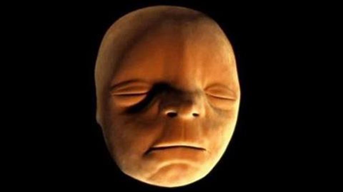 Απίστευτο: Δείτε πώς παίρνει μορφή το πρόσωπο του εμβρύου στη μήτρα