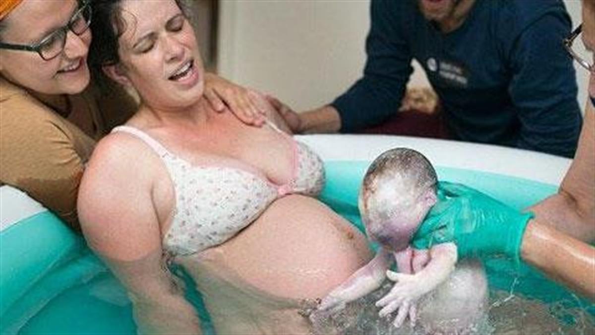 Δείτε πώς ένα μωρό γεννιέται μέσα στον αμνιακό σάκο!