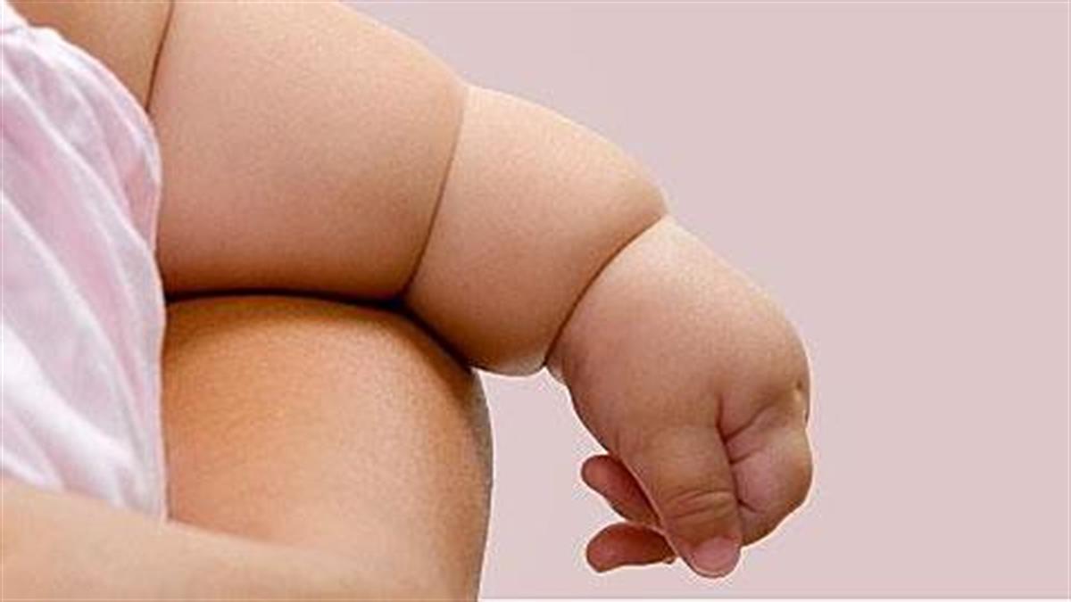 Οι Έλληνες γονείς μεγαλώνουν τα πιο παχύσαρκα παιδιά παγκοσμίως