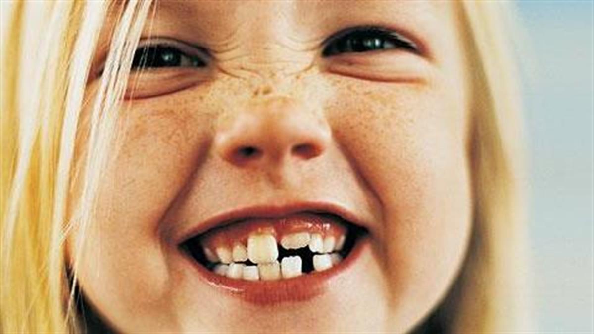 Τι πρέπει να κάνετε αν το παιδί σας έχει στραβά δόντια