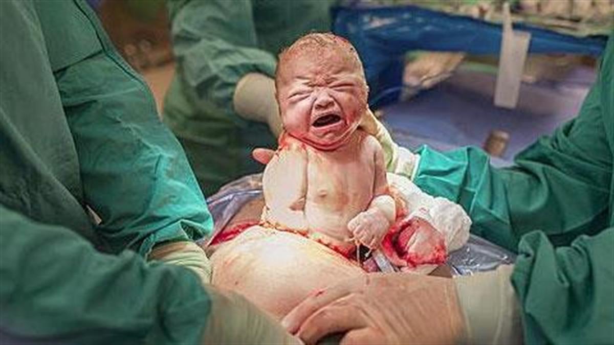 17 δυνατές φωτογραφίες αποδεικνύουν ότι κάθε γέννα είναι μοναδική!