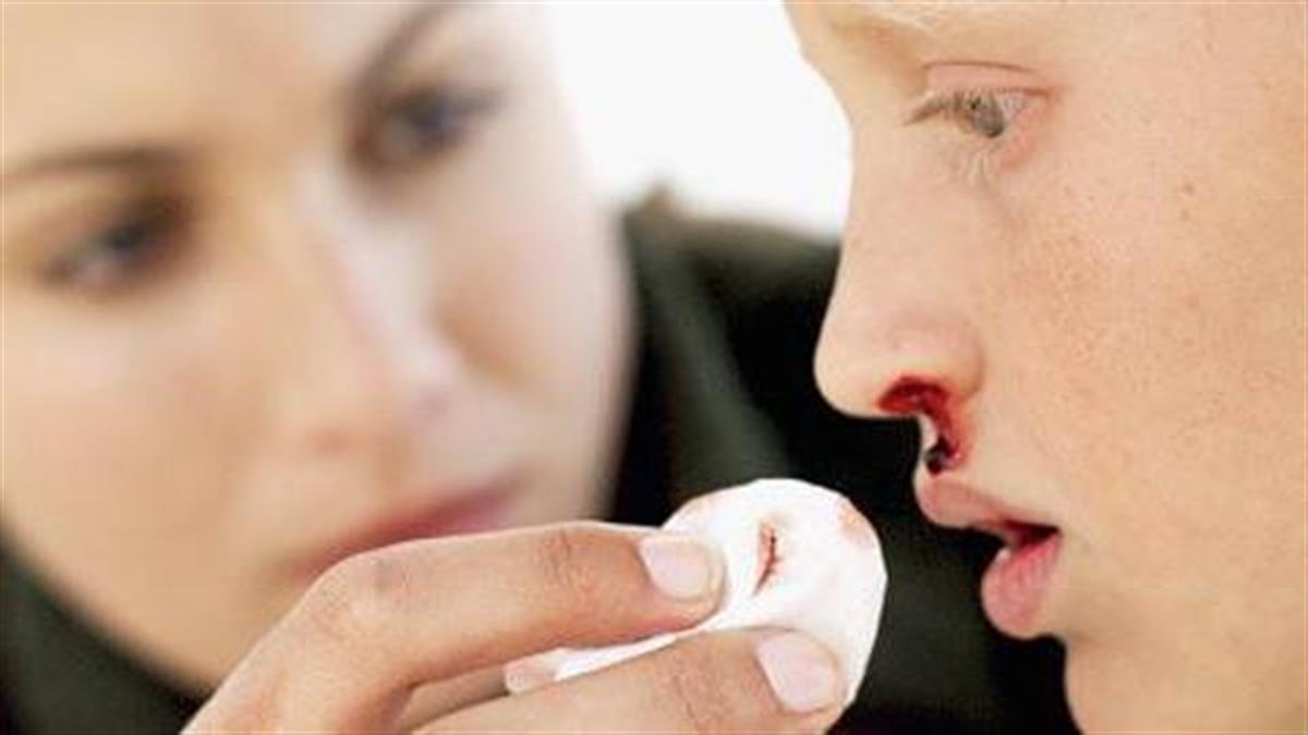 Άνοιξε η μύτη του παιδιού: Πώς θα αντιμετωπίσετε τη ρινορραγία