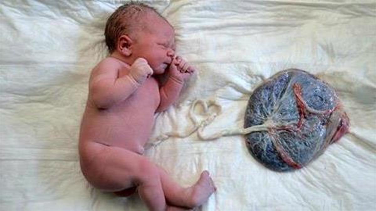 10 φωτογραφίες μωρών λίγο πριν τους κόψουν τον ομφάλιο λώρο