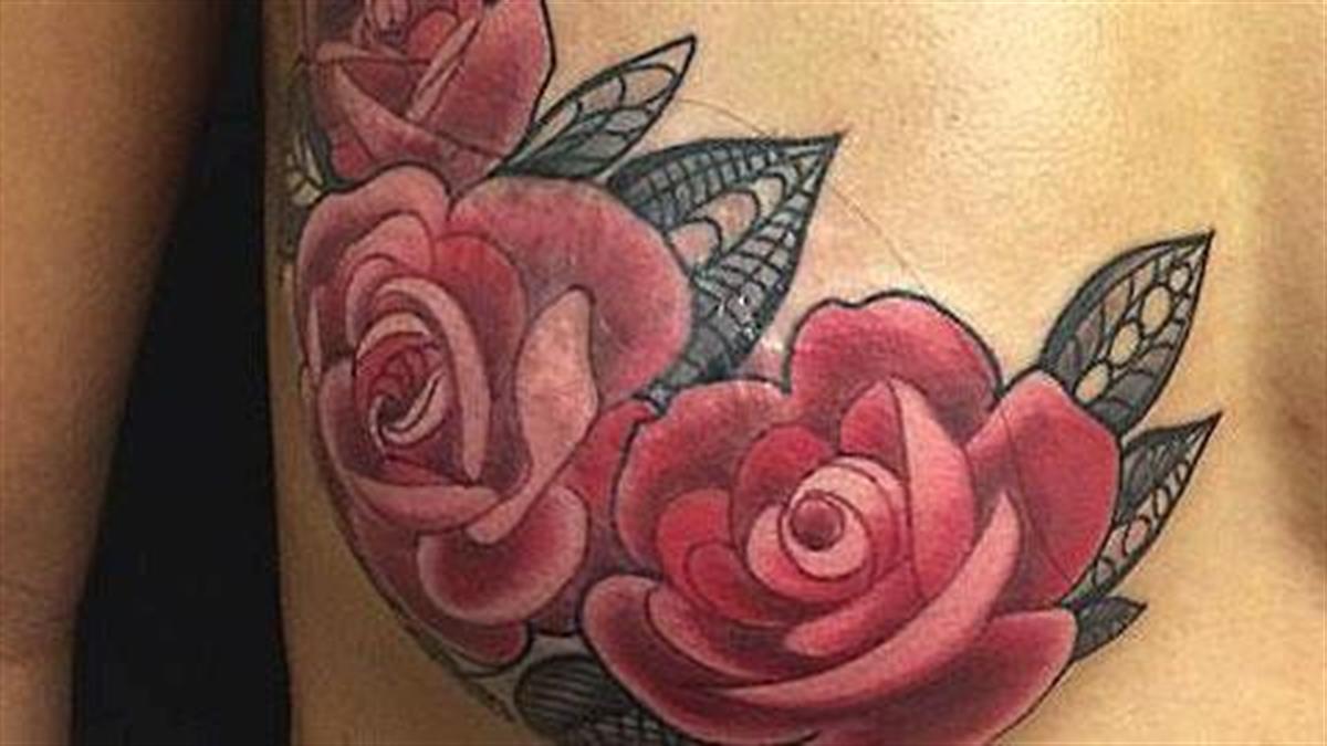 10 υπέροχα τατουάζ που μεταμορφώνουν ουλές σε έργα τέχνης