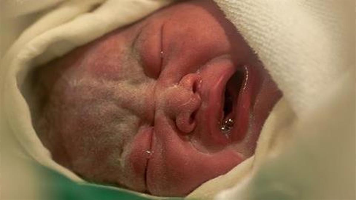 Μια απίστευτα σπάνια φωτογραφία μωρού που γεννιέται με το… πρόσωπο!