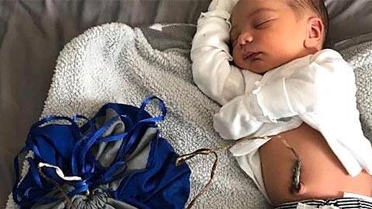 Γιατί αυτή η μητέρα αποφάσισε να μην κόψει τον ομφάλιο λώρο του μωρού της μετά τη γέννα