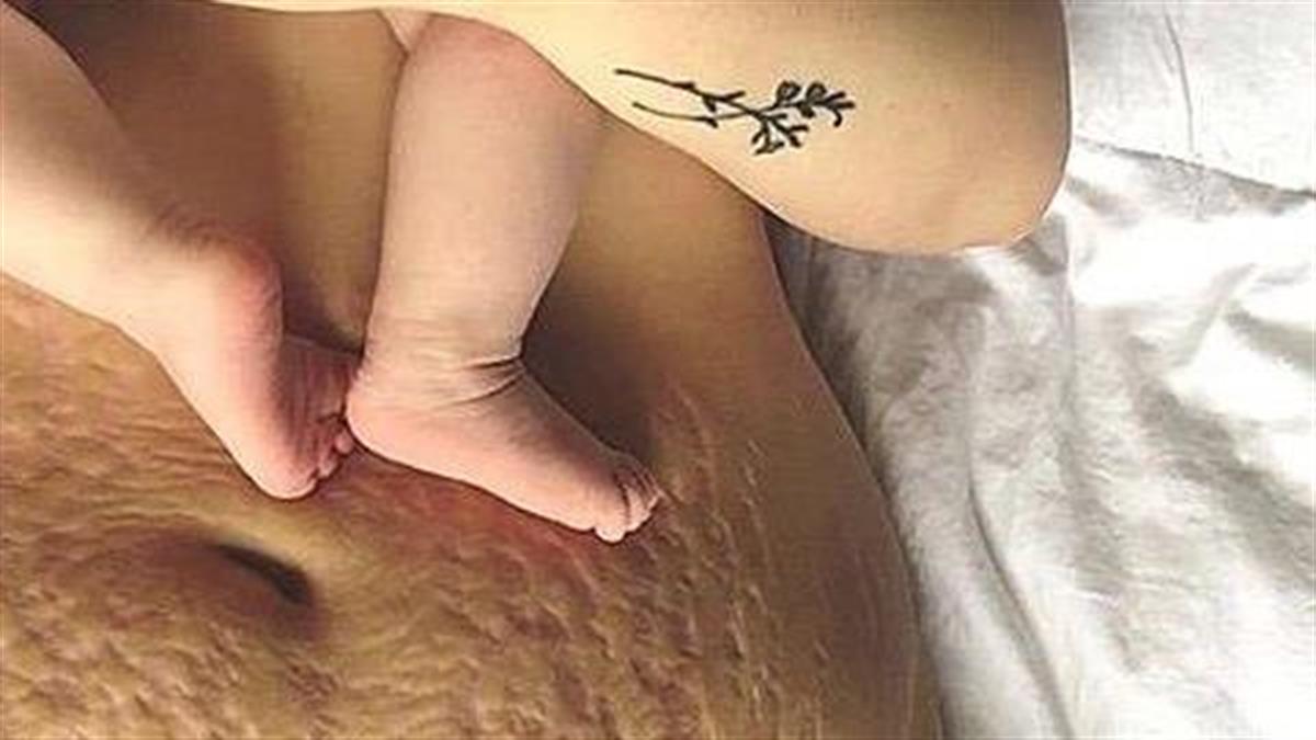 Πώς είναι το σώμα της γυναίκας μετά την εγκυμοσύνη: 11 ρεαλιστικές φωτογραφίες