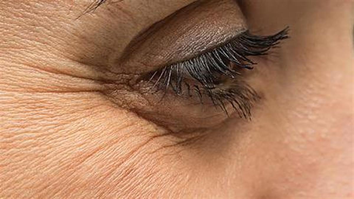 Πώς να φροντίσετε σωστά την περιοχή γύρω από τα μάτια για να μην κάνετε ρυτίδες