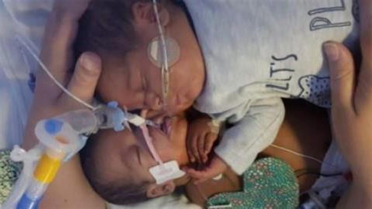 Νεογέννητο κινδύνευε να πεθάνει αλλά τον έσωσε η αγκαλιά του δίδυμου αδερφού του
