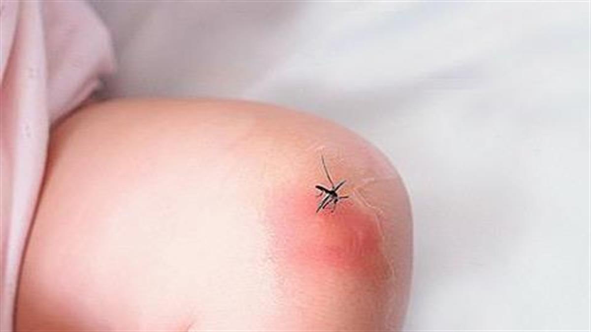Πώς να κρατήσετε τα επικίνδυνα τσιμπήματα των κουνουπιών μακριά από τα μωρά