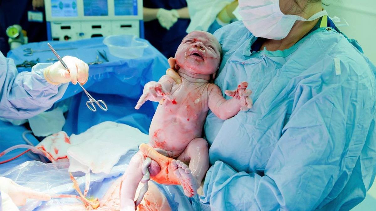Η εμπειρία της γέννας με καισαρική μέσα από 10 συγκλονιστικές φωτογραφίες