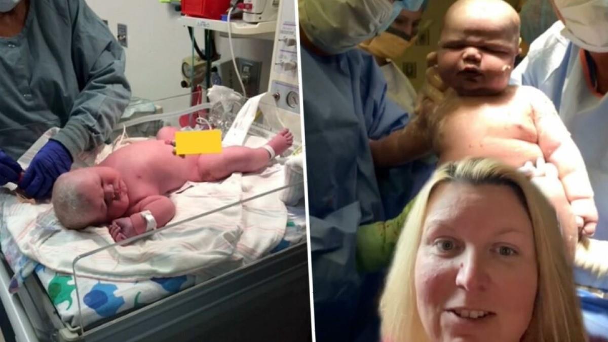 Μαμά γέννησε αγοράκι που ζυγίζει 6 κιλά και φοράει ρούχα για μωρό… 9 μηνών