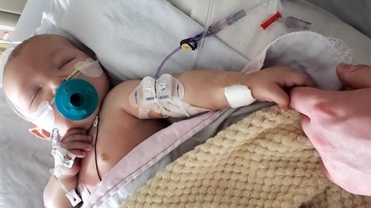 Μωράκι 4 μηνών με όγκο στην κοιλιά σώθηκε μετά από χειρουργείο που κράτησε 7 ώρες