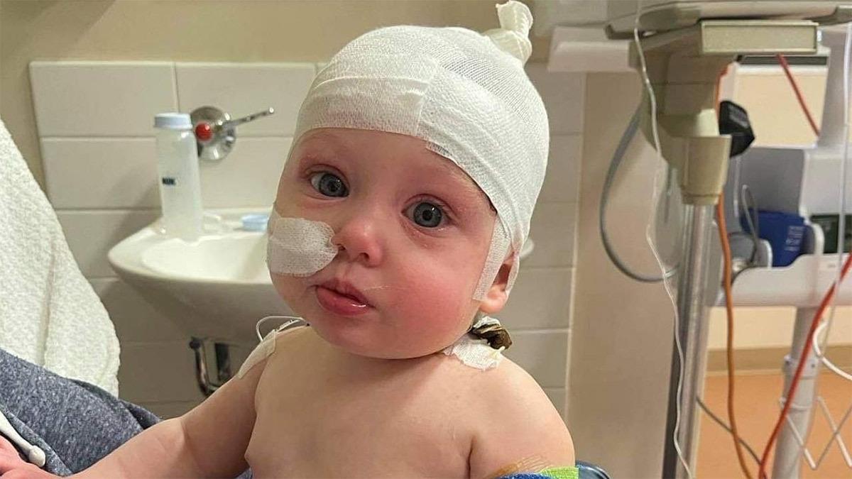 7 μηνών μωρό υπέστη σοβαρά εγκαύματα και τυφλώθηκε προσωρινά από... σεσουάρ μαλλιών