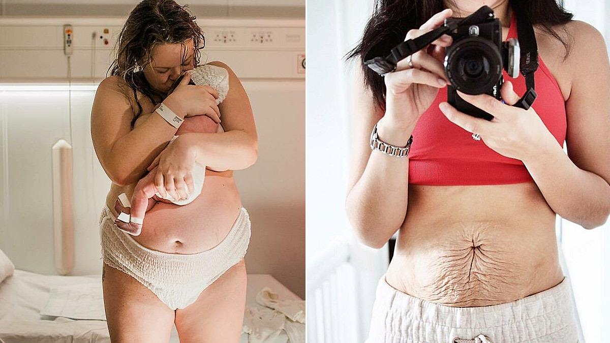 Το σώμα μετά τον τοκετό: 14 αληθινές φωτογραφίες από αληθινές γυναίκες