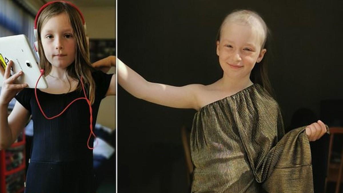 8χρονη έχασε τα μαλλιά της λόγω ψυχαναγκαστικής διαταραχής