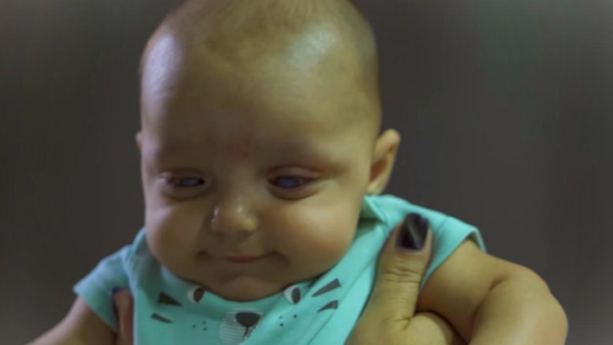 Μωρό 5 μηνών με σπάνια πάθηση έκανε την εγχείρηση που θα του αλλάξει τη ζωή