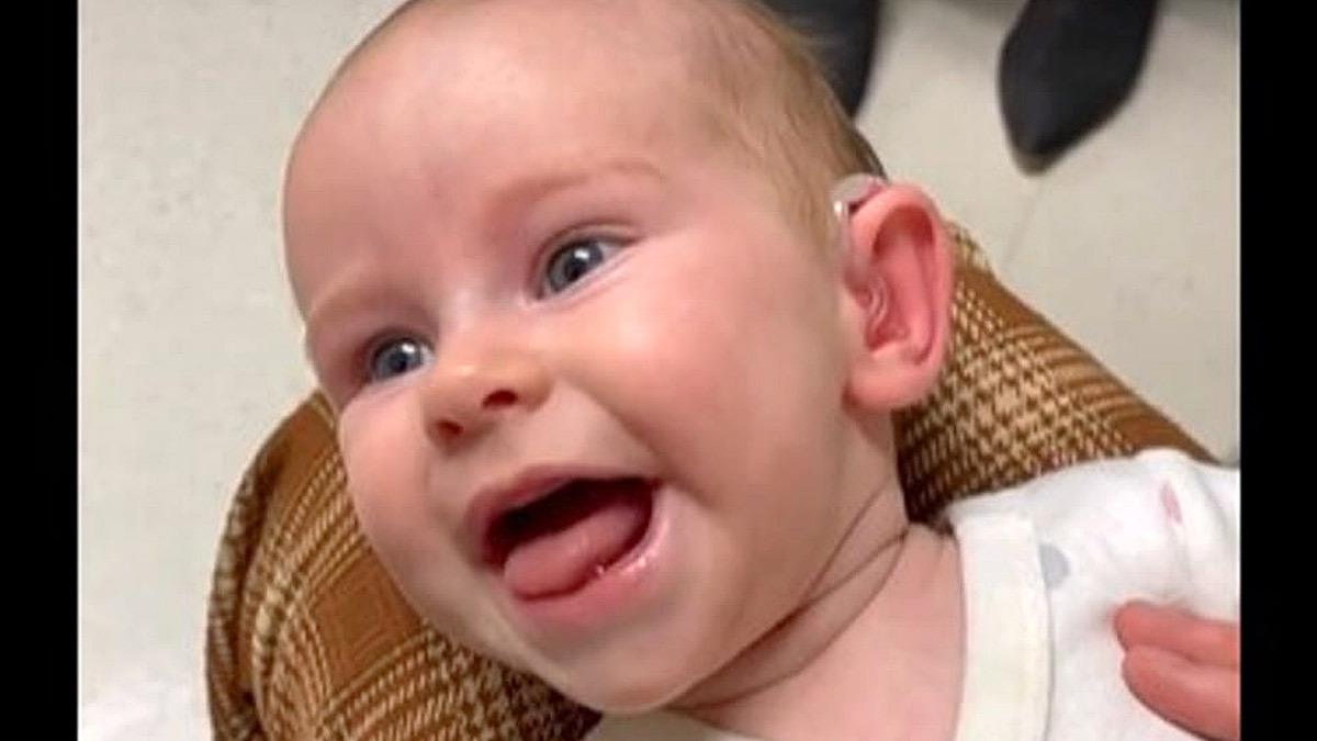 Μωρό με προβλήματα ακοής χαίρεται σαν τρελό όταν ακούει για 1η φορά τη μαμά του