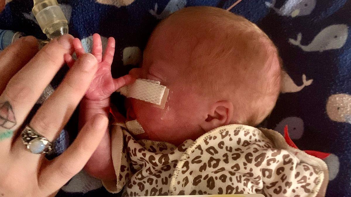 Πρόωρο μωρό γεννήθηκε στις 22 βδομάδες - έπαθε 4 φορές πνευμονία και το ξεπέρασε