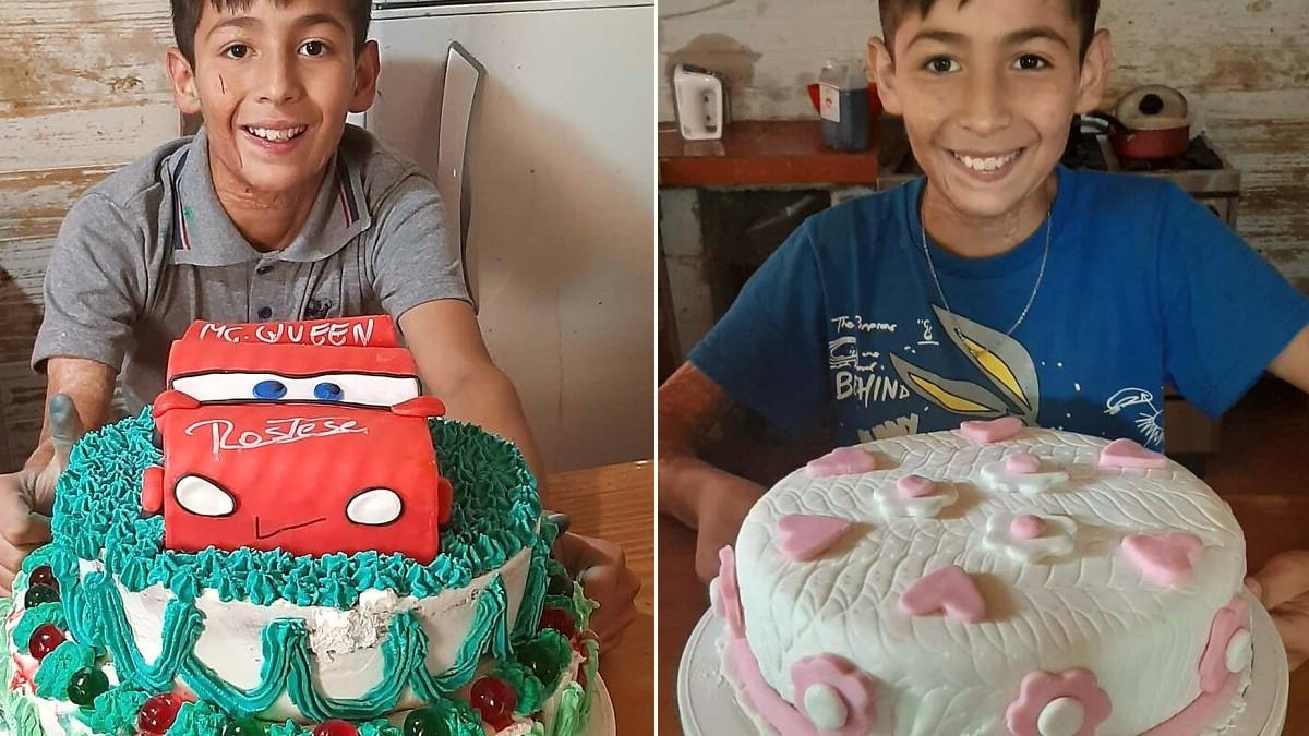 10χρονος με σοβαρά εγκαύματα φτιάχνει γλυκά για να πληρώσει τις επεμβάσεις του