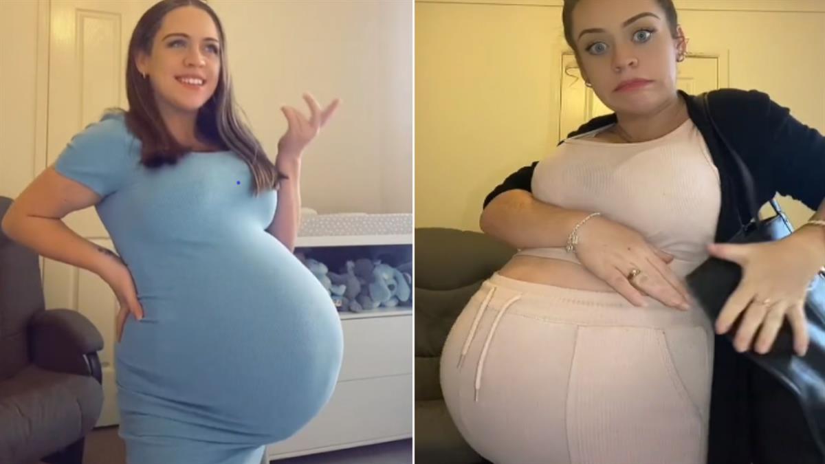 Eτοιμόγεννη που περιμένει ένα μωρό μοιάζει σαν να είναι έγκυος σε 4δυμα!