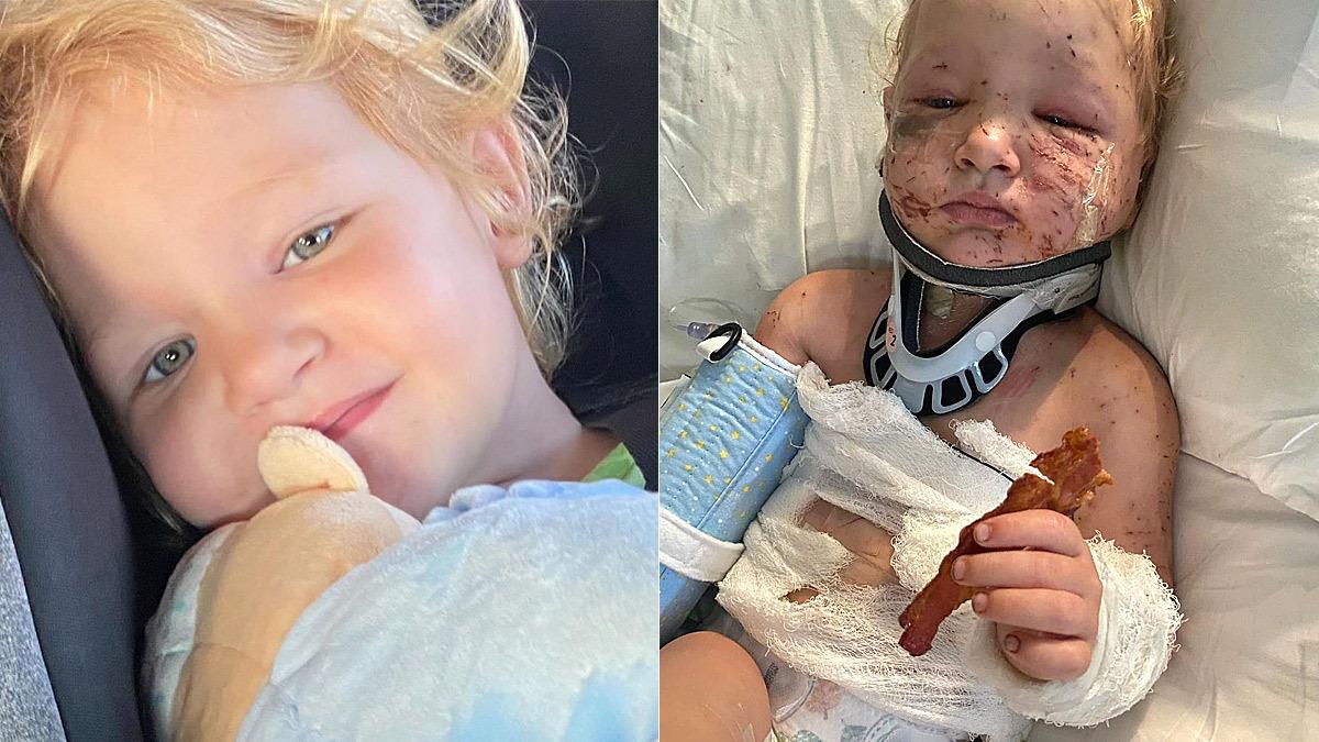 2χρονη δέχτηκε φονική επίθεση από τα κουτάβια της - της έφαγαν το αφτί
