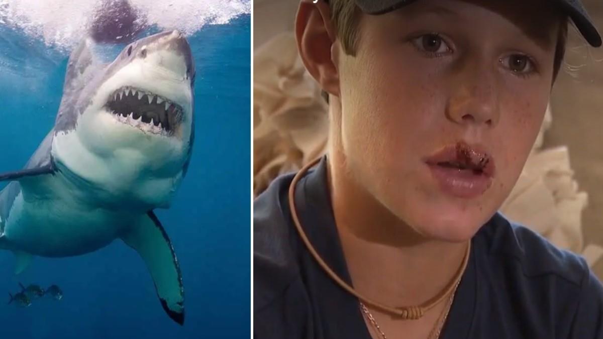 13χρονος πιάστηκε στα δόντια… καρχαρία και τη γλίτωσε μόνο με 10 ράμματα!