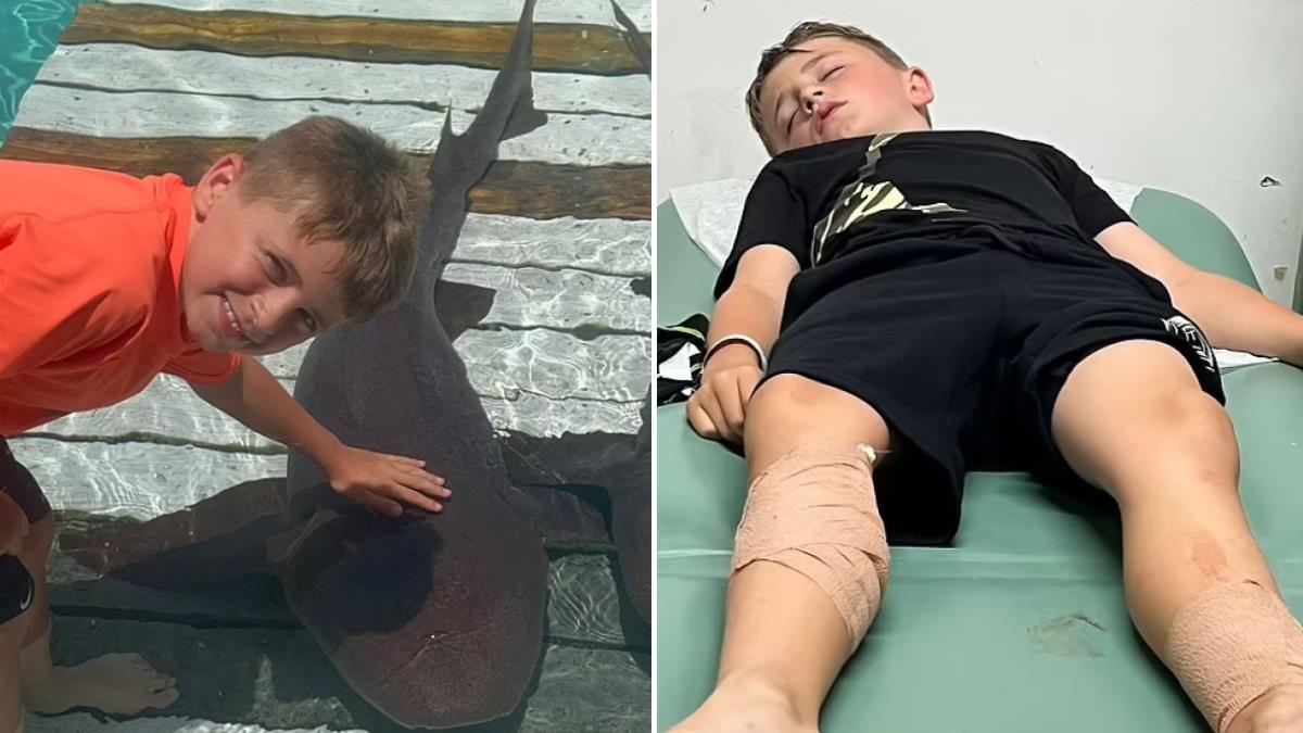 8χρονος δέχθηκε επίθεση από... καρχαρίες και τον έσωσε η 12χρονη αδερφή του!