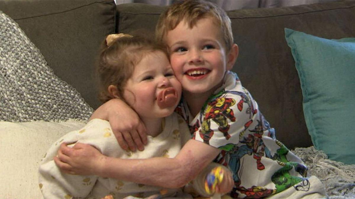 5χρονος έσωσε τη μικρή του αδερφή από φωτιά - την κάλυψε με το σώμα του