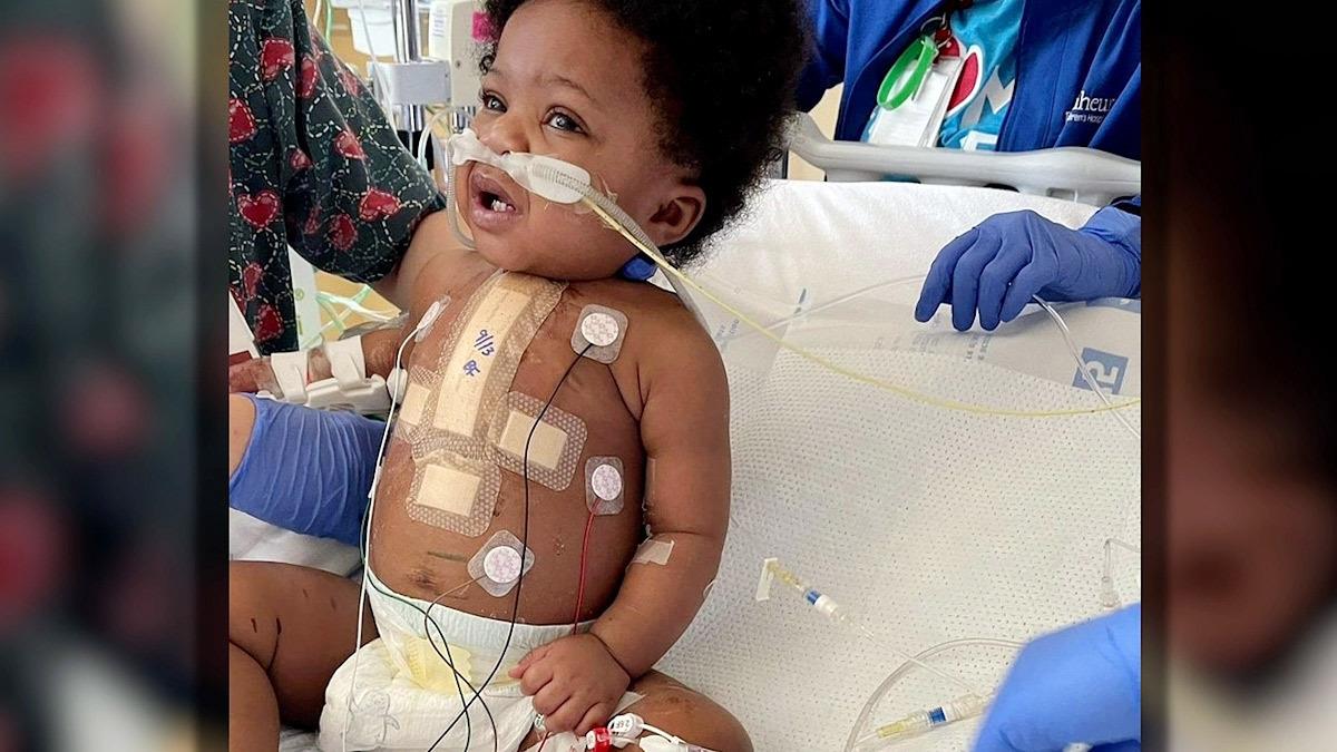 Μωράκι που γεννήθηκε με μισή καρδιά, έκανε την επέμβαση που του έσωσε τη ζωή!